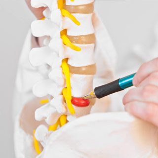 chiropractor bridgeport Connecticut Spine & Rehab